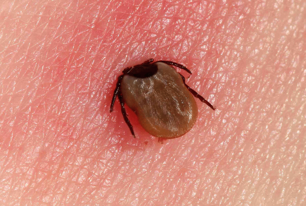 Lyme disease treatment in Hindi